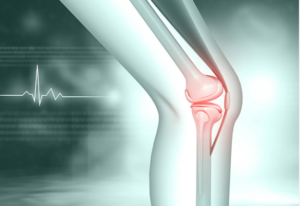 Joint Replacement Surgery